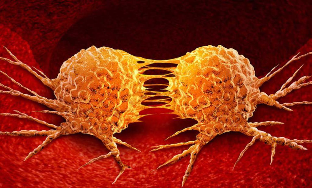 متاستاتیک چیست؟