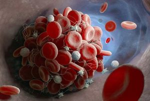 آیا بالا بودن گلبول های سفید خطرناک است؟