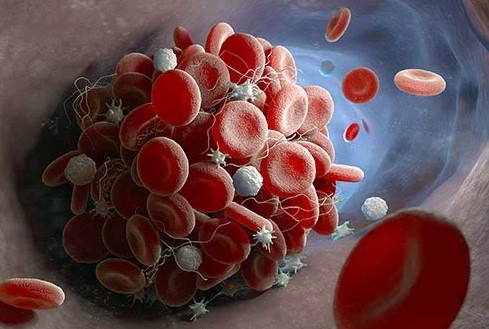 آیا بالا بودن گلبول های سفید خطرناک است؟