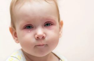 عفونت چشم نوزاد