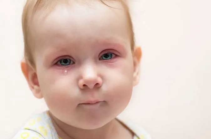 عفونت چشم نوزاد