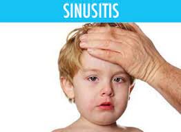 سینوزیت در کودکان