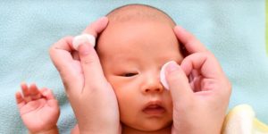 آبریزش چشم نوزاد