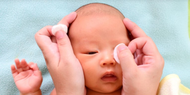 آبریزش چشم نوزاد