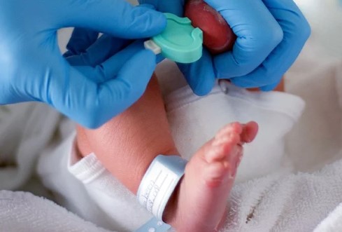 فنیل کتونوری